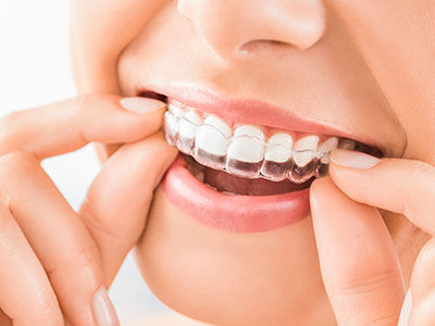 Beautiful smile and white teeth of a young woman.