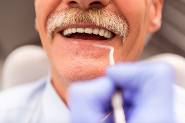Dentures Offer Numerous Advantages To People Without Teeth