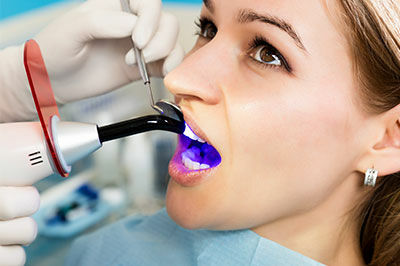 Dental Bonding